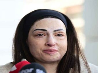 Ιωάννα Παλιοσπύρου: Η ζωή της και η επίθεση με βιτριόλι έγιναν ντοκιμαντέρ – Στόχος να ταξιδέψει στο εξωτερικό