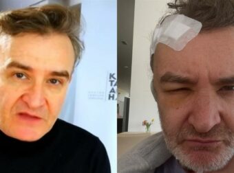 Νίκος Ορφανός: Χειρουργείο για όγκο στον εγκέφαλο για τον γνωστό ηθοποιό – Η περιπέτεια που κανείς δε γνώριζε