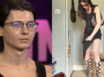 Θυμάστε τον Σάμουελ Τότσι από το GNTM; Τι κάνει και που βρίσκεται σήμερα