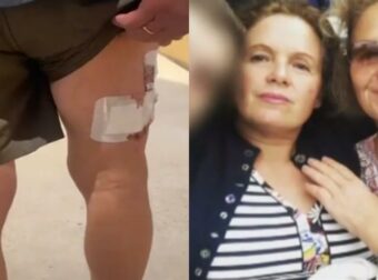 «Μπλέχτηκε» η οικογένεια Τσιτσιπά για την επίθεση του σκύλου: Η… ανομοιότητα των δίδυμων αδερφών και ο αυτόπτης μάρτυρας