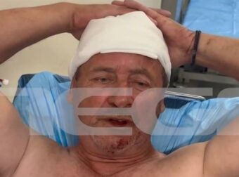 «Σήκωσε το μαχαίρι και με χτύπησε»: Ανατριχιάζει ο υπάλληλος του Δήμου Αθηναίων που δέχθηκε επίθεση από τοξικομανή