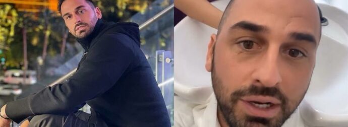 Άρης Σοϊλέδης: Έκανε μεταμόσχευση μαλλιών – (Βίντεο)