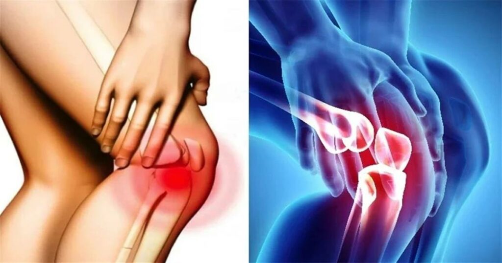 Σας πονάνε τα γόνατα; Οι επιστήμονες… μίλησαν αυτά είναι τα καλύτερα παπούτσια για όσους έχουν πρόβλημα και ποια απαγορεύονται αυστηρά