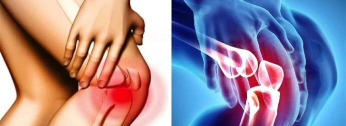 Σας πονάνε τα γόνατα; Οι επιστήμονες… μίλησαν αυτά είναι τα καλύτερα παπούτσια για όσους έχουν πρόβλημα και ποια απαγορεύονται αυστηρά