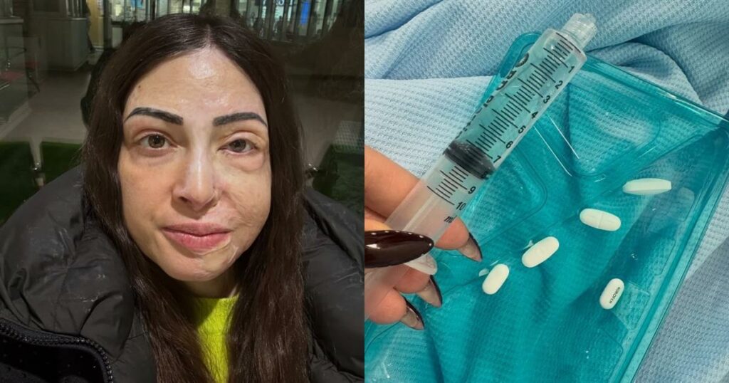 Παλιοσπύρου: Φωτογραφίες & βίντεο από τον δύσκολο αγώνα της αποθεραπείας – «Με ρωτάς πως αντέχω…»