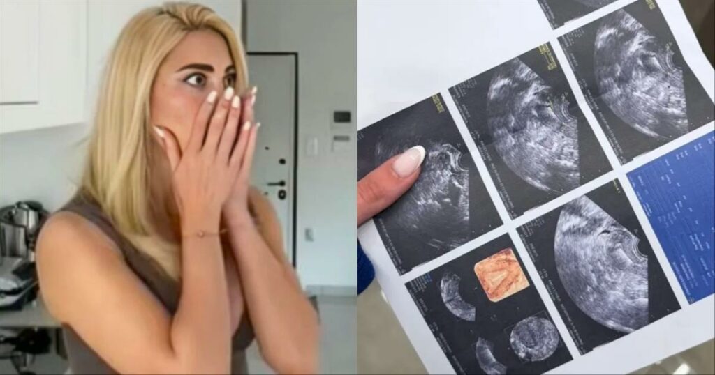 «Καλέ είσαι έγκυος;»: Η Ιωάννα Τούνη, ανέβασε τον υπέρηχο σε βίντεο και όλες είδαν αυτό που «μάλλον» ήθελε να κρύψει…