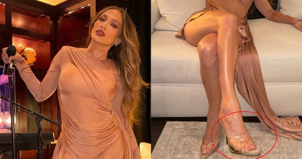 Τζένιφερ Λόπεζ: Σάλος με φωτογραφία που ανέβασε – Φαίνεται να έχει 6 δάχτυλα στα πόδια!