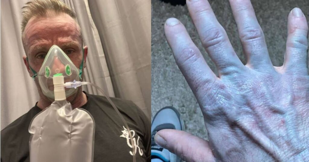 Ξύπνησε και ήταν όλος μπλε: Όταν πήγε στο νοσοκομείο οι γιατροί έκλαψαν από τα γέλια