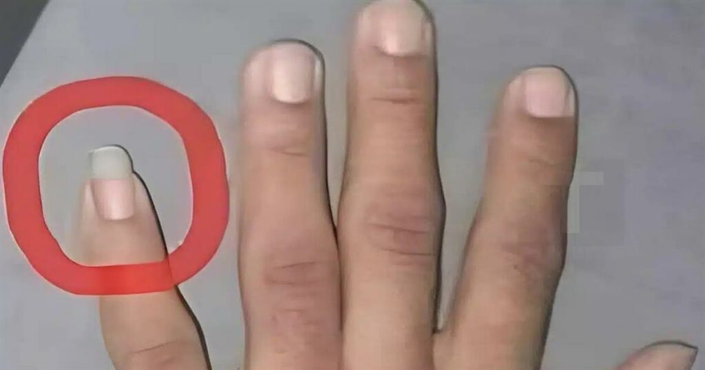 Γιατί μερικοί άντρες αφήνουν το νύχι του μικρού δαχτύλου μακρύ;