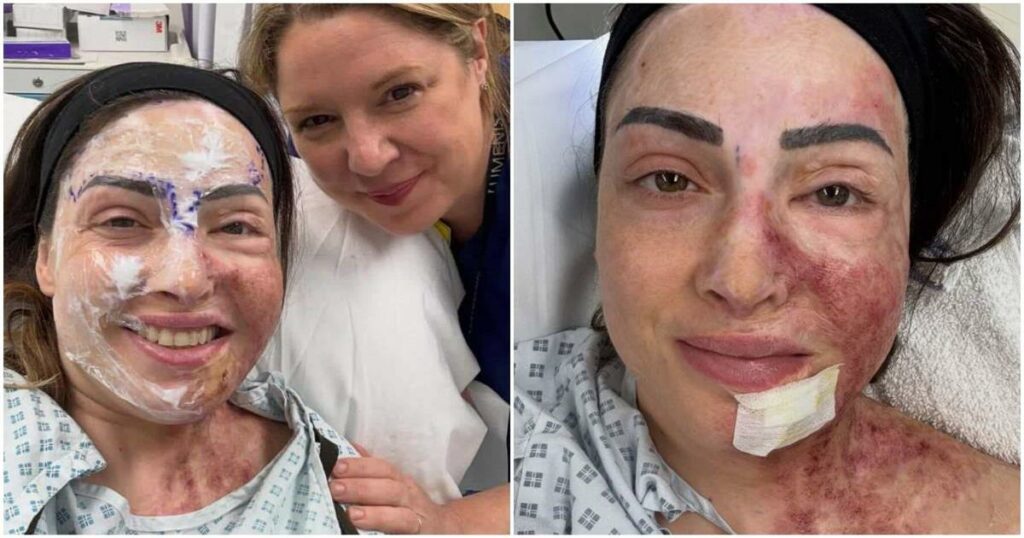 Φωτογραφίες από το νέο πρόσωπο της Ιωάννας Παλιοσπύρου: Η ωμή αλήθεια χωρίς φίλτρα – «Δεν είναι όμορφο. Πονάει. Αλλά χτίζω τον εαυτό μου ξανά»