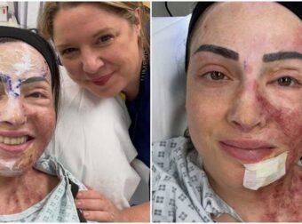 Φωτογραφίες από το νέο πρόσωπο της Ιωάννας Παλιοσπύρου: Η ωμή αλήθεια χωρίς φίλτρα – «Δεν είναι όμορφο. Πονάει. Αλλά χτίζω τον εαυτό μου ξανά»