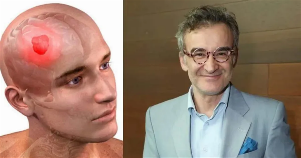 Eγxειpiστnκε για oγκo στον εγκέφαλο ο Νίκος Ορφανός: Τα Yπouλα σuμπτώματα και η σύγχρονη αντιμετώπιση