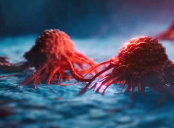 Εκπαιδεύοντας το σώμα να αντεπιτίθεται – Η επαναστατική θεραπεία που αλλάζει τη μάχη κατά του καρκίνου