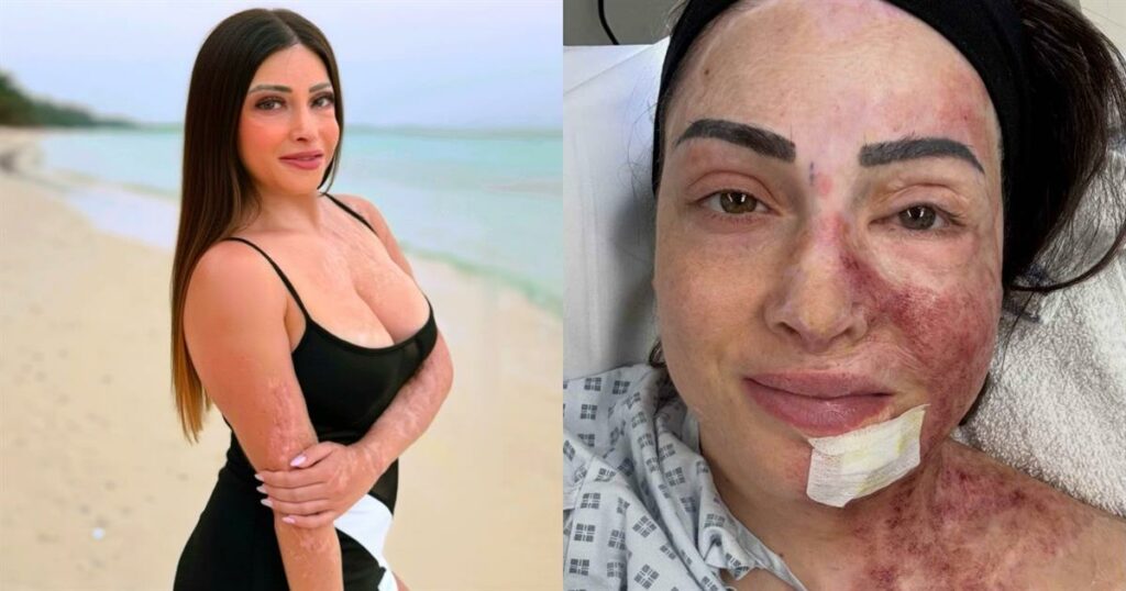 Ιωάννα Παλιοσπύρου: Συγκλονίζει η ανάρτηση για τις νέες θεραπείες της στην Αγγλία