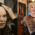 «Δεν με νοιάζει που δεν έχω στήθος» – Οι Ελληνίδες celebrities που συγκλόνισαν με τη μάχη τους με τον καρκίνο