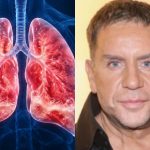 Τι είναι το πνευμονικό οίδημα που υπέστη ο Γιώργος Μαζωνάκης – Οι αιτίες & τα συμπτώματα