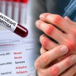 Ρευματοειδής αρθρίτιδα: Τα «σιωπηλά» σημάδια στο αίμα που μπορεί να εμφανίζονται χρόνια πριν από τους πόνους